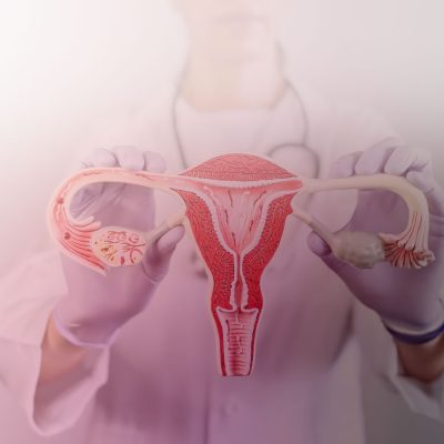 Hpv e Alterações no Colo do Útero: Quando a Conização é Necessária